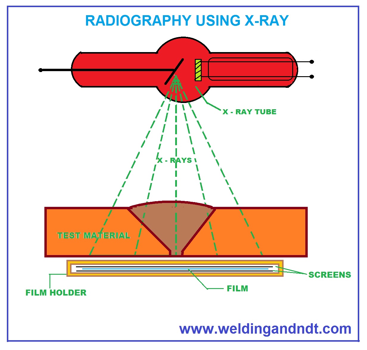 X-Ray Radiography technique